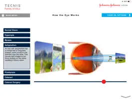 Game screenshot TECNIS® Vision Simulator apk