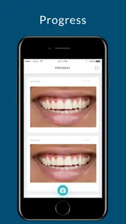 bites dental iphone screenshot 2