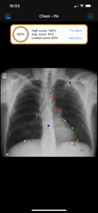 Xray Anatomy screenshot #5 for iPhone