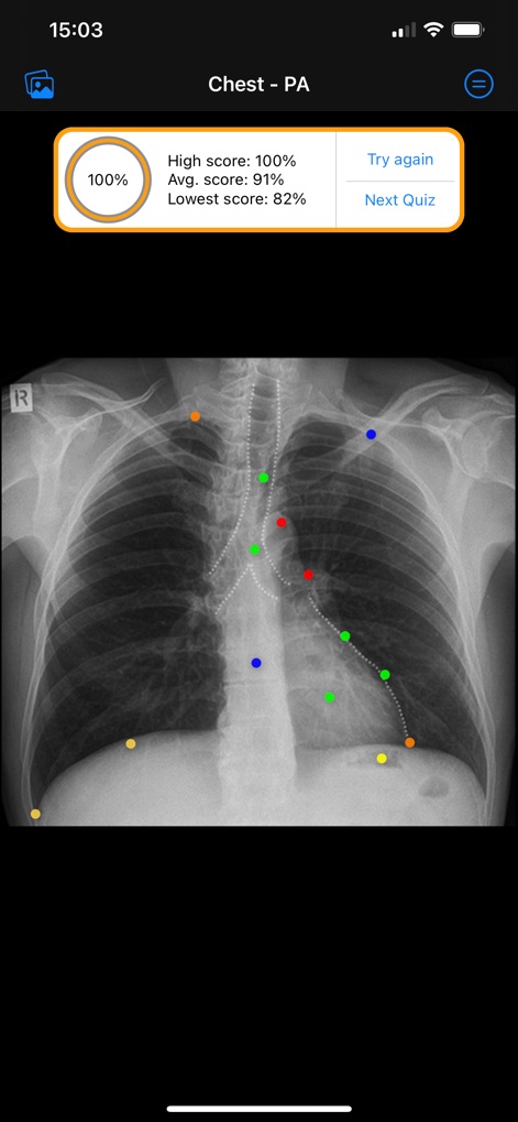Xray Anatomy - Experience the interactive QuizMe Mode, which provides immediate performance feedback with a score summary and options to 'Try again' or proceed to the 'Next Quiz' for continuous learning.