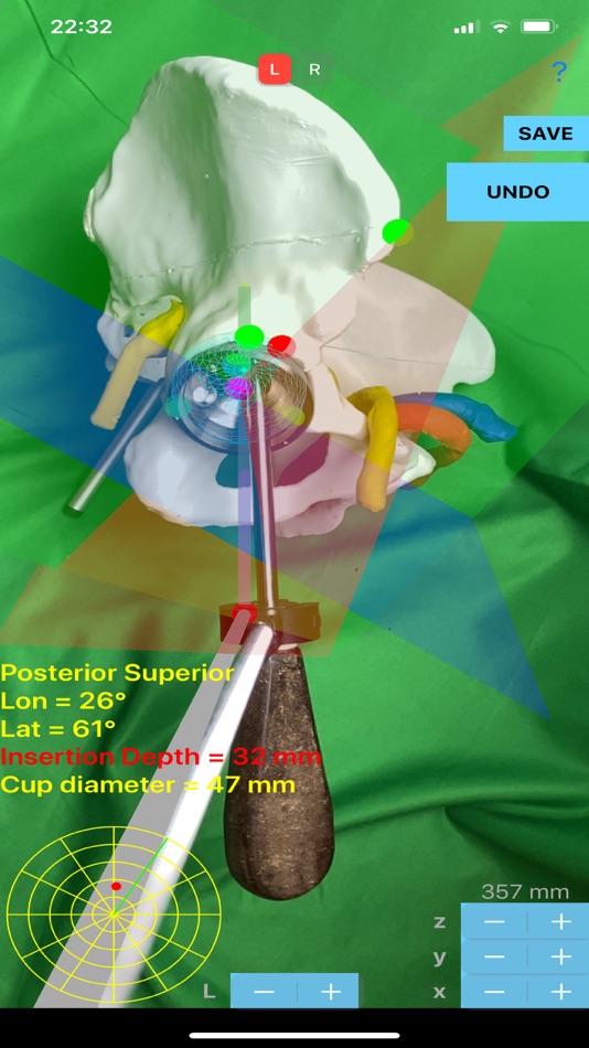 #6. ScrewCupNaviAR (iOS) 由: ORTHOPRACTIS.COM SINGLE MEMBER P.C.