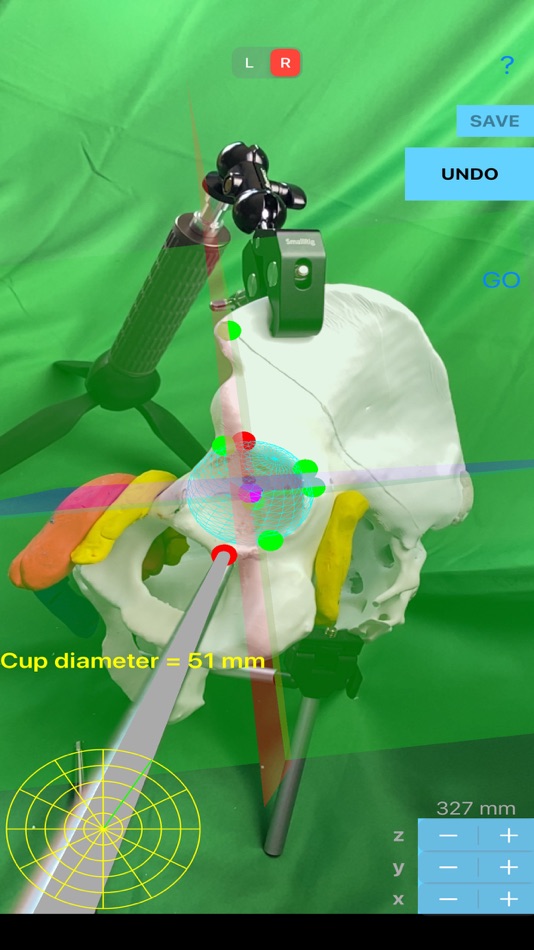 #10. ScrewCupNaviAR (iOS) 由: ORTHOPRACTIS.COM SINGLE MEMBER P.C.