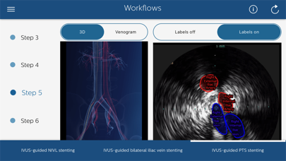 Philips Venous IVUS Tutor Screenshot
