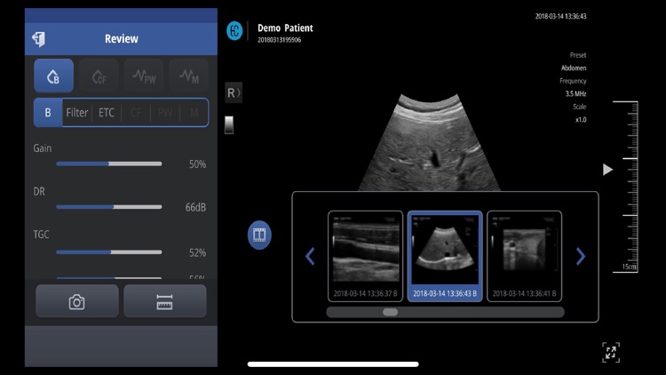 SONON X Ultrasound App US / KR