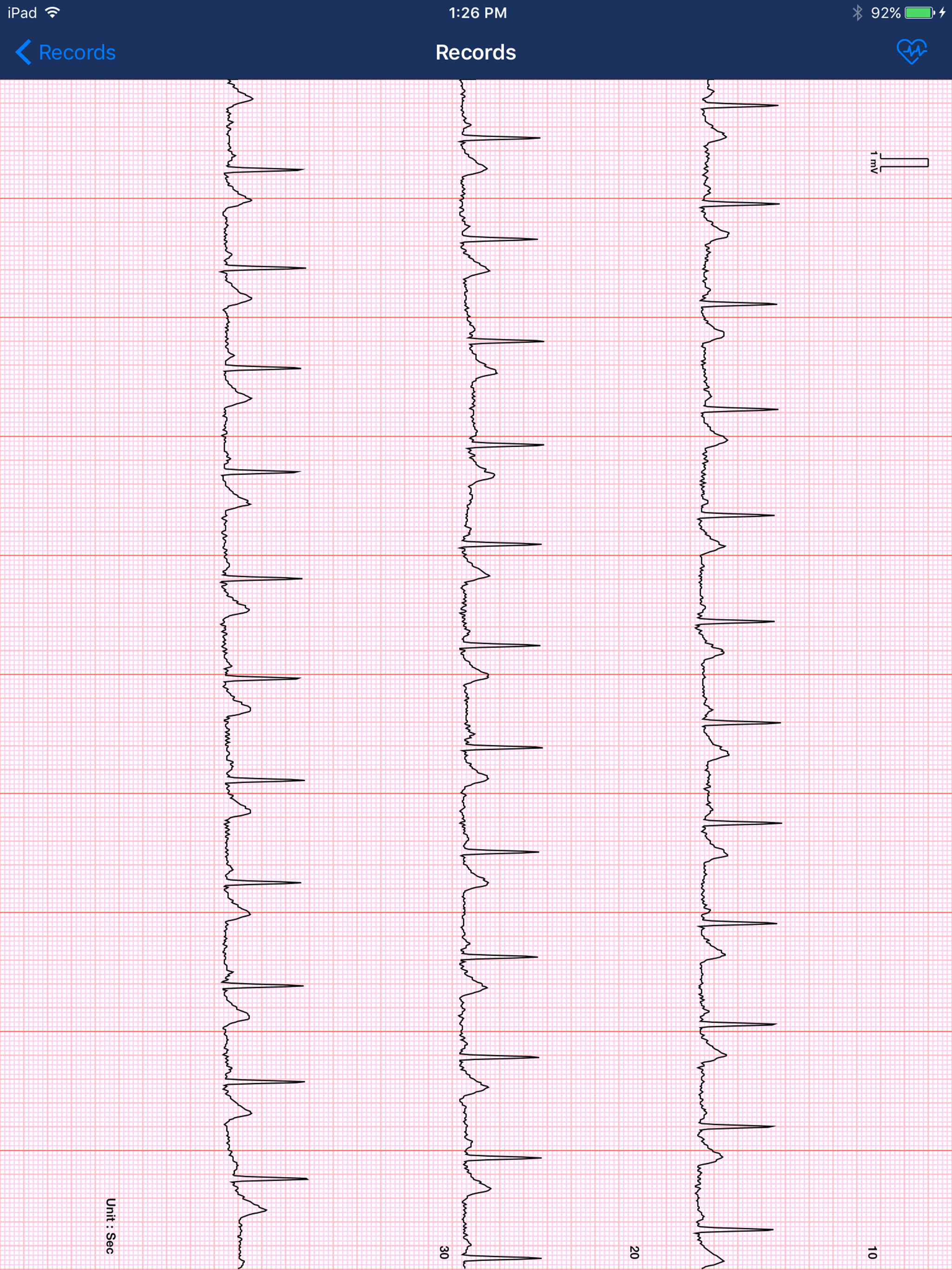 medel iBP ECG screenshot 9