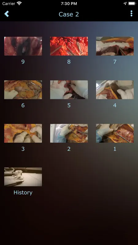Autopsy screenshot 3 of 3