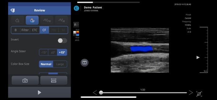 SONON X Ultrasound App US - KR