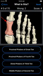 anatomy foot quiz problems & solutions and troubleshooting guide - 4