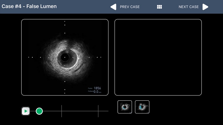 IVUS + Physiology Pro