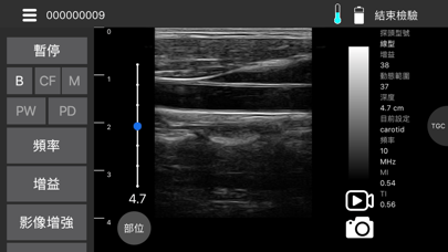 Screenshot #1 pour MediConnect - ASUS Ultrasound