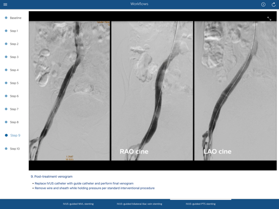 Philips Venous IVUS Tutor iPad screenshot 8 - Medical app