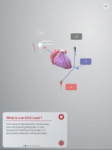 3D ECG Leadsのおすすめ画像9