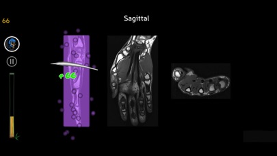 Anatomy Ninja Upper Limbのおすすめ画像3