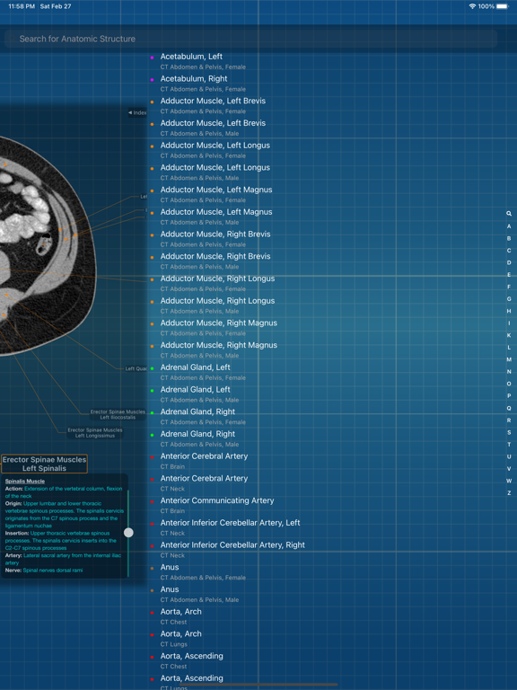 Screenshot #6 pour X-Anatomy Pro