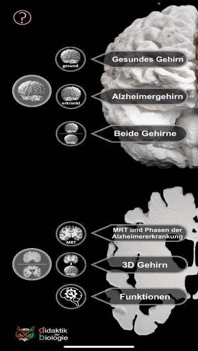 Alzheimer AR Screenshot