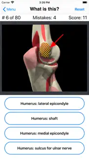 anatomy shoulder quiz problems & solutions and troubleshooting guide - 3
