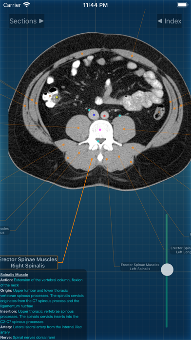 X-Anatomy Pro Screenshot