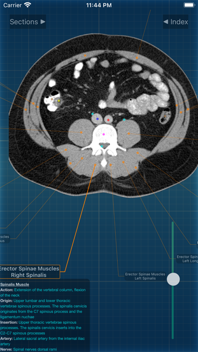 X-Anatomy Proのおすすめ画像2