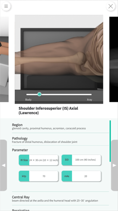 Navi Radiography Pro Screenshot