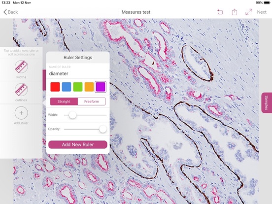 Screenshot #5 pour Segmentum Imaging
