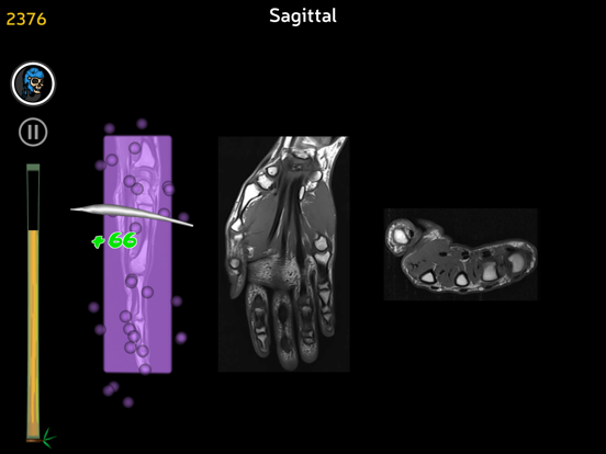 Anatomy Ninja Upper Limbのおすすめ画像4