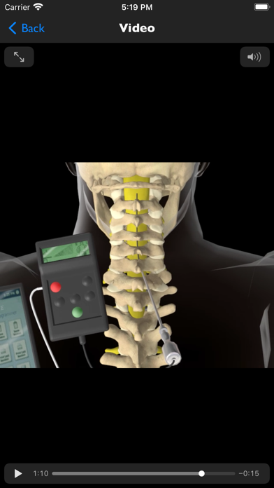 iSpinePainManagement Screenshot