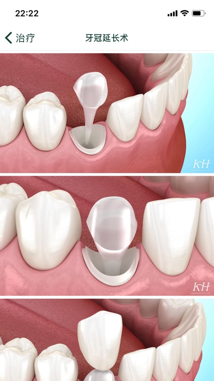 口腔图谱 screenshot-9