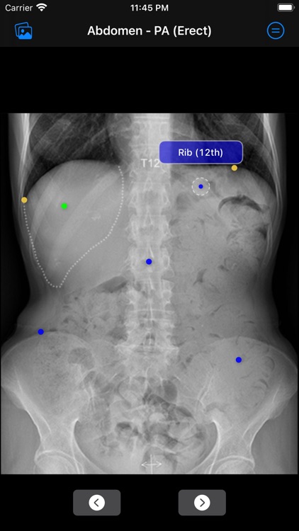 Xray Anatomy