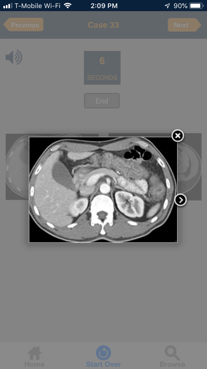 CTisus 10 Minute ER Challenge