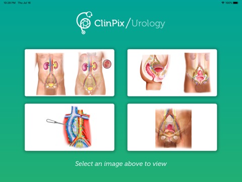ClinPix: Urologyのおすすめ画像1