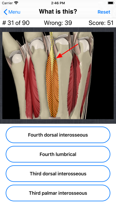 Anatomy Hand Quizのおすすめ画像6