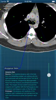 x-anatomy pro iphone screenshot 4