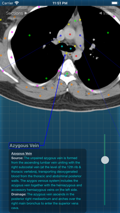 X-Anatomy Pro Screenshot