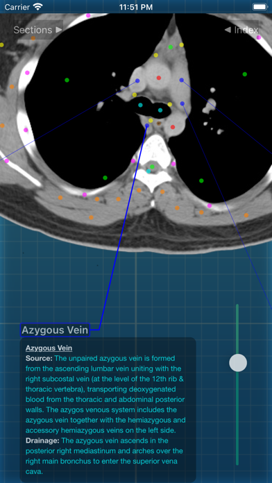 X-Anatomy Proのおすすめ画像4