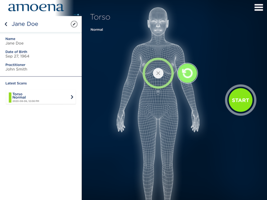 Screenshot #6 pour Amoena 3DScan