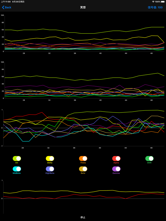 Screenshot #4 pour BrainLink Dual——双通道脑波检测