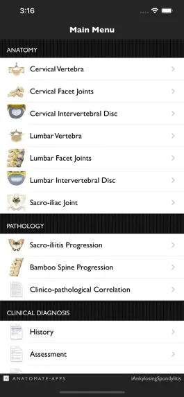 Game screenshot iAnkylosingSpondylitis Pro apk