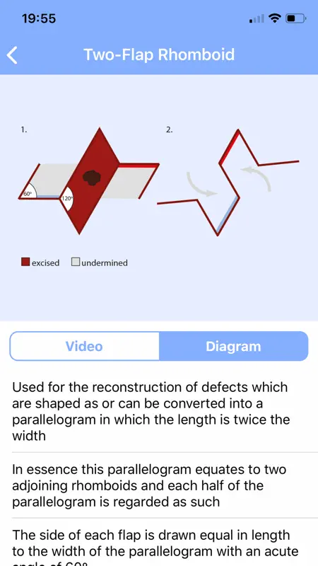 Surgical Flaps screenshot 1 of 3