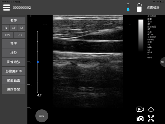 Screenshot #4 pour MediConnect - ASUS Ultrasound