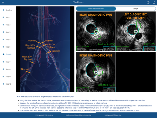 Philips Venous IVUS Tutor iPad screenshot 5 - Medical app
