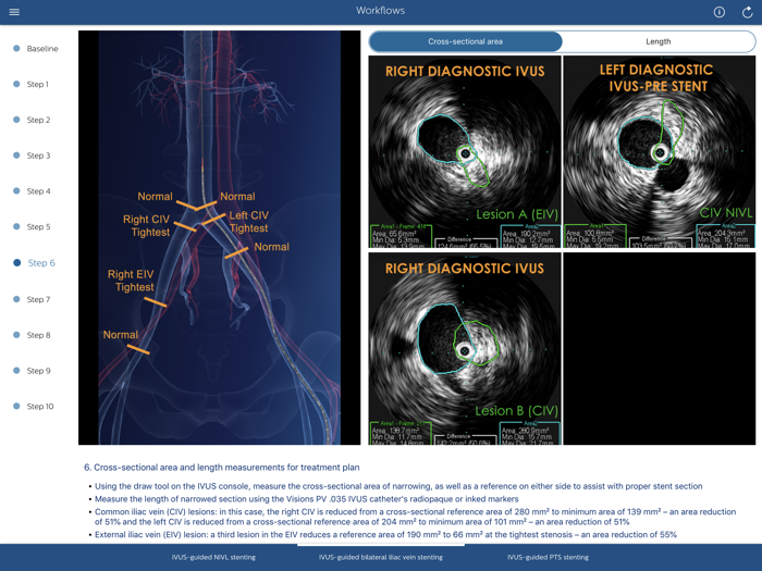 Philips Venous IVUS Tutor