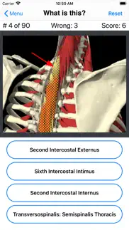 How to cancel & delete anatomy spine quiz 3