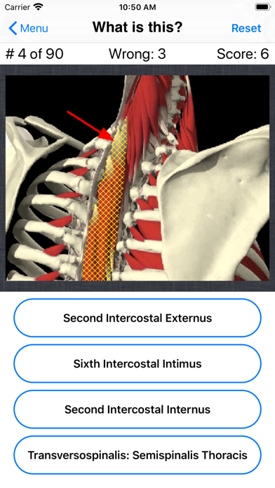 Anatomy Spine Quiz Screenshot