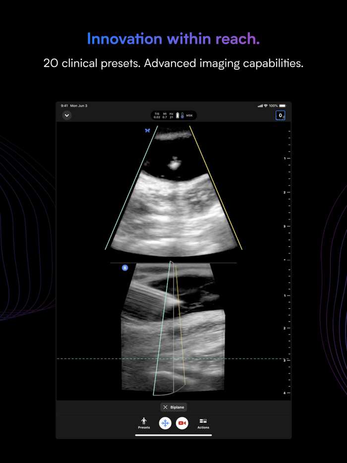 Butterfly iQ — Ultrasound