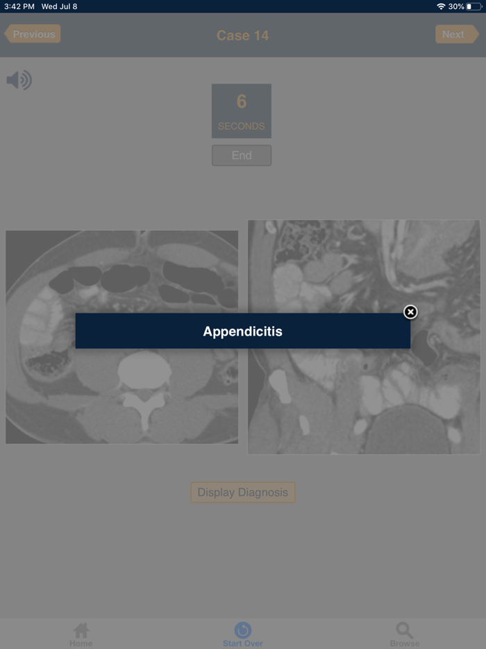 CTisus 10 Minute ER Challenge