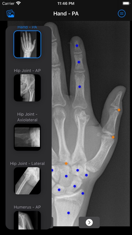 Xray Anatomy