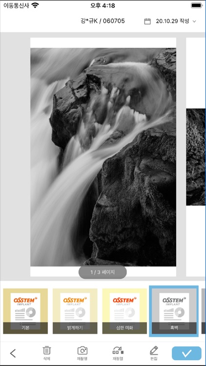 OSSTEM Chart Scan screenshot-6