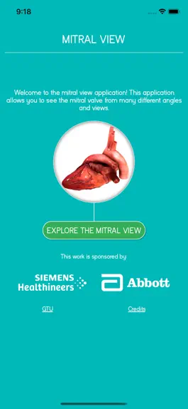 Game screenshot Mitral View mod apk