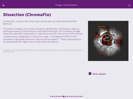 Screenshot #5 pour Philips Coronary IVUS Tutor
