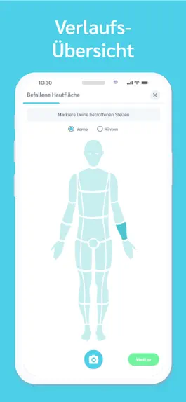 Game screenshot Psoriasis Helferin | Sorea apk